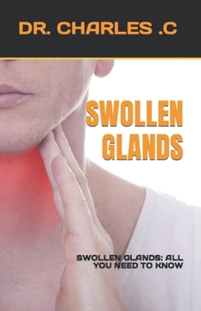 Paperback Swollen Glands: Swollen Glands: All You Need to Know Book