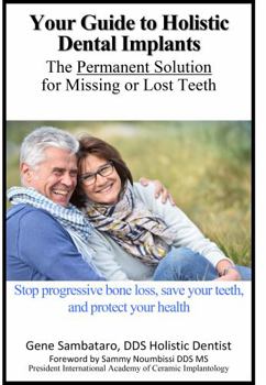 Your Guide to Holistic Dental Implants : The Permanent Solution for Missing or Lost Teeth