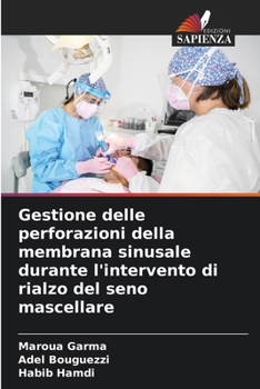 Paperback Gestione delle perforazioni della membrana sinusale durante l'intervento di rialzo del seno mascellare [Italian] Book