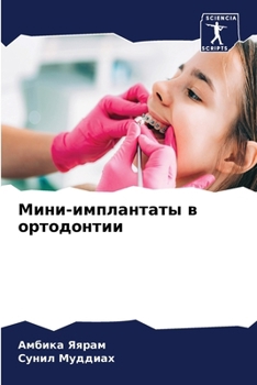 Paperback Мини-имплантаты в ортодо [Russian] Book