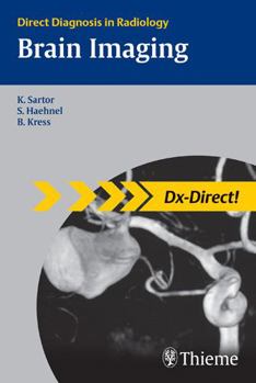 Paperback Brain Imaging: Direct Diagnosis in Radiology Book