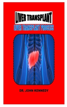 Paperback Liver Transplant: Liver Transplant Process Book