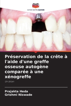 Paperback Préservation de la crête à l'aide d'une greffe osseuse autogène comparée à une xénogreffe [French] Book