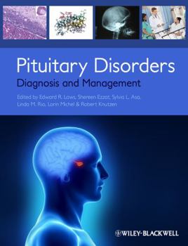 Paperback Pituitary Disorders Book