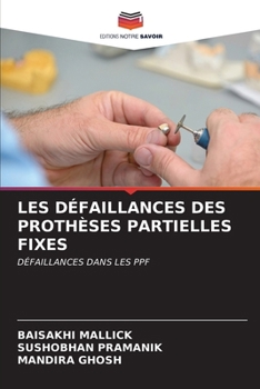 Paperback Les Défaillances Des Prothèses Partielles Fixes [French] Book