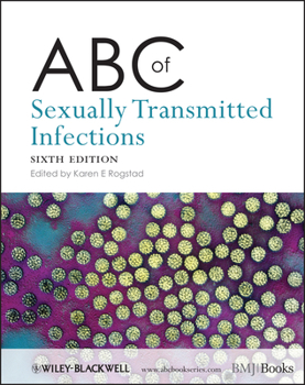Paperback ABC of Sexually Transmitted Infections Book