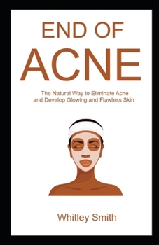 Paperback End of Acne: The Natural Way to Eliminate Acne and Develop Glowing and Flawless Skin Book