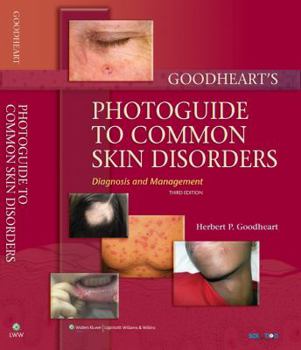 Hardcover Goodheart's Photoguide to Common Skin Disorders: Diagnosis and Management [With Access Code] Book