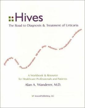 Paperback Hives: The Road to Diagnosis and Treatment on Urticaria Book