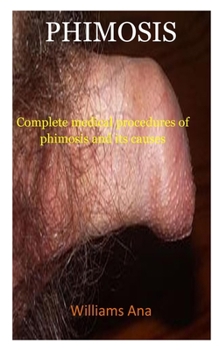 Paperback Phimosis: A complete medical procedure of phimosis and its causes Book