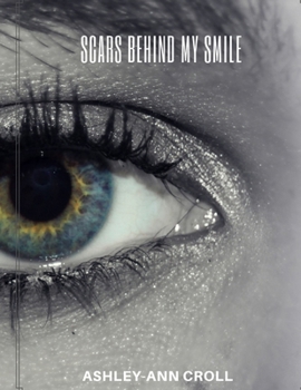 Paperback Scars Behind My Smile Book