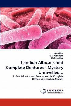 Paperback Candida Albicans and Complete Dentures - Mystery Unravelled... Book