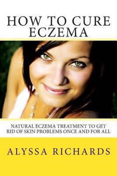 Paperback How To Cure Eczema: Natural Eczema Treatment To Get Rid Of Skin Problems Once And For All Book