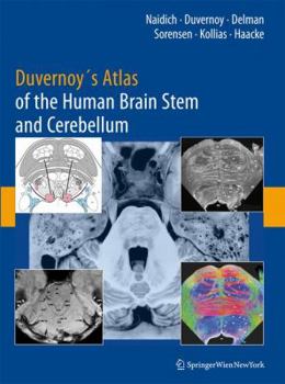 Hardcover Durvernoy's Atlas of the Human Brain Stem and Cerebellum Book
