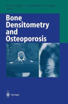 Hardcover Bone Densitometry and Osteoporosis Book