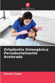 Paperback Ortodontia Osteogênica Periodontalmente Acelerada [Portuguese] Book