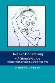 Paperback Hives & Skin Swelling A Simple Guide: to nettle rash, urticaria & angio-oedema Book