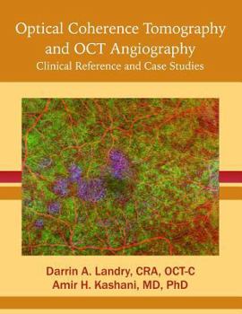Paperback Optical Coherence Tomography and Oct Angiography: Clinical Reference and Case Studies Book