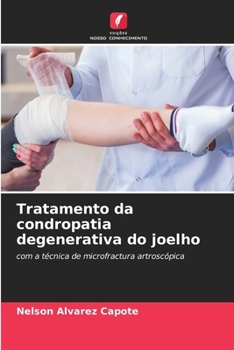 Tratamento da condropatia degenerativa do joelho (Portuguese Edition)