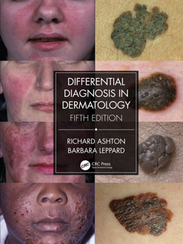 Hardcover Differential Diagnosis in Dermatology Book