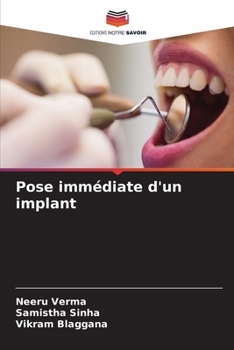 Paperback Pose immédiate d'un implant [French] Book