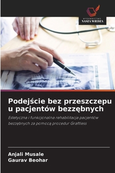 Paperback Podej&#347;cie bez przeszczepu u pacjentów bezz&#281;bnych [Polish] Book