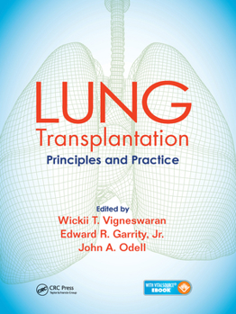 Paperback Lung Transplantation: Principles and Practice Book
