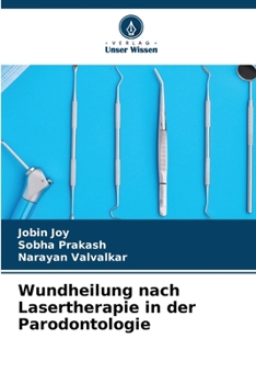 Paperback Wundheilung nach Lasertherapie in der Parodontologie [German] Book