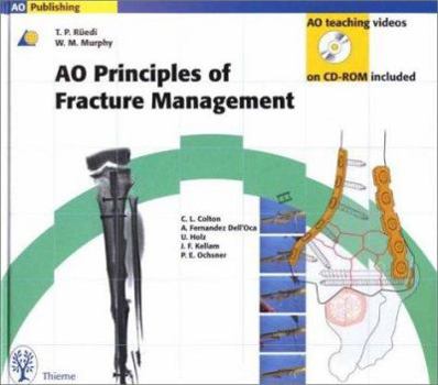 Paperback Principles of Fracture Management Book