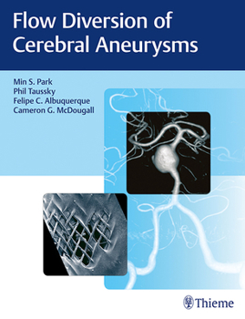 Hardcover Flow Diversion of Cerebral Aneurysms Book