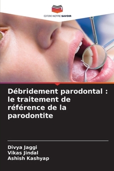 Paperback Débridement parodontal: le traitement de référence de la parodontite [French] Book