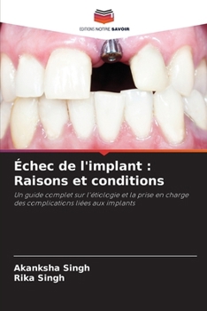 Paperback Échec de l'implant: Raisons et conditions [French] Book