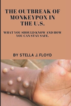 Paperback The outbreak of monkeypox in the U.S: What you should know and how you can stay safe. Book