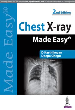 Paperback Chest X-ray Made Easy Book