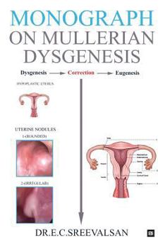 Paperback Monograph on Mullerian Dysgenesis Book