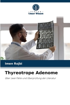Paperback Thyreotrope Adenome [German] Book
