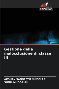 Gestione della malocclusione di classe III