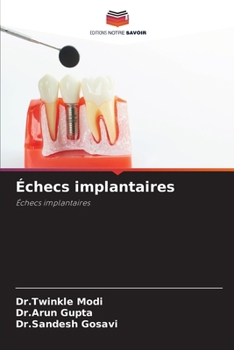 Paperback Échecs implantaires [French] Book