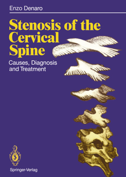 Paperback Stenosis of the Cervical Spine: Causes, Diagnosis and Treatment Book