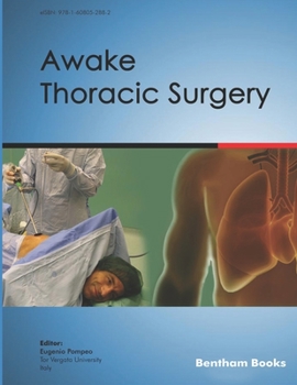 Paperback Awake Thoracic Surgery Book