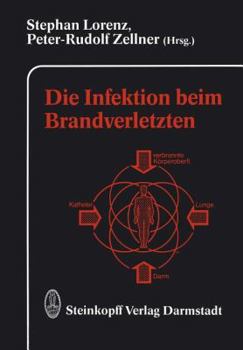 Paperback Die Infektion Beim Brandverletzten [German] Book