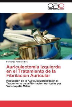 Paperback Auriculectomia Izquierda En El Tratamiento de La Fibrilacion Auricular [Spanish] Book