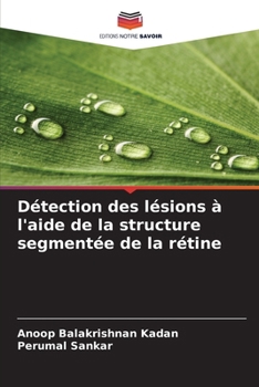 Paperback Détection des lésions à l'aide de la structure segmentée de la rétine [French] Book