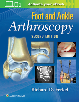 Hardcover Foot & Ankle Arthroscopy Book