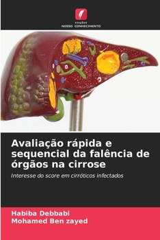 Avaliação rápida e sequencial da falência de órgãos na cirrose (Portuguese Edition)