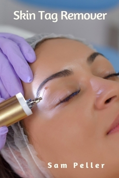 Paperback Skin Tag Remover Book