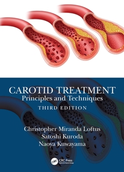 Hardcover Carotid Treatment: Principles and Techniques Book