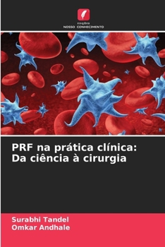 PRF na prática clínica: Da ciência à cirurgia (Portuguese Edition)