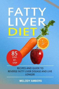Paperback Fatty Liver Diet: 85 Step-by-Step Recipes and Guide To Reverse Fatty Liver Disease And Live Longer Book