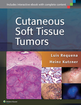 Hardcover Cutaneous Soft Tissue Tumors Book